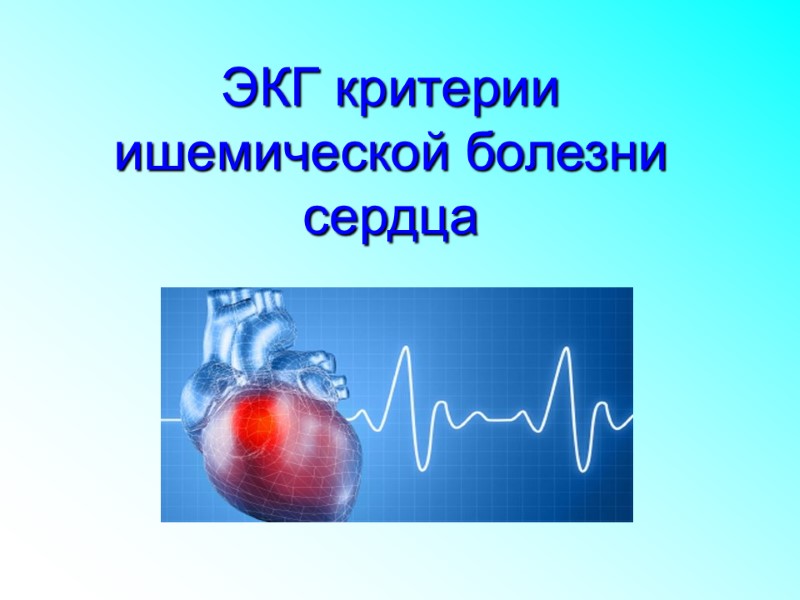 ЭКГ критерии  ишемической болезни сердца